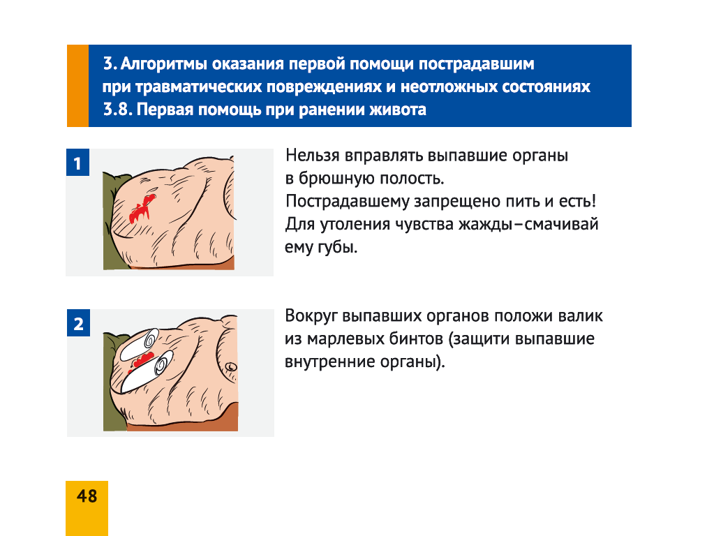 При ранении нельзя тест. Алгоритм оказания первой помощи при ранении живота:. Оказание первой помощи при травме живота. Алгоритм помощи при травме живота. Алгоритм действия первой помощи при ранении живота.